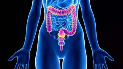 Oncogramme®: Une thérapie à la carte