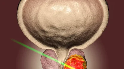 Etude AMPLITUDE: Cancer de la prostate avec mutation HRR